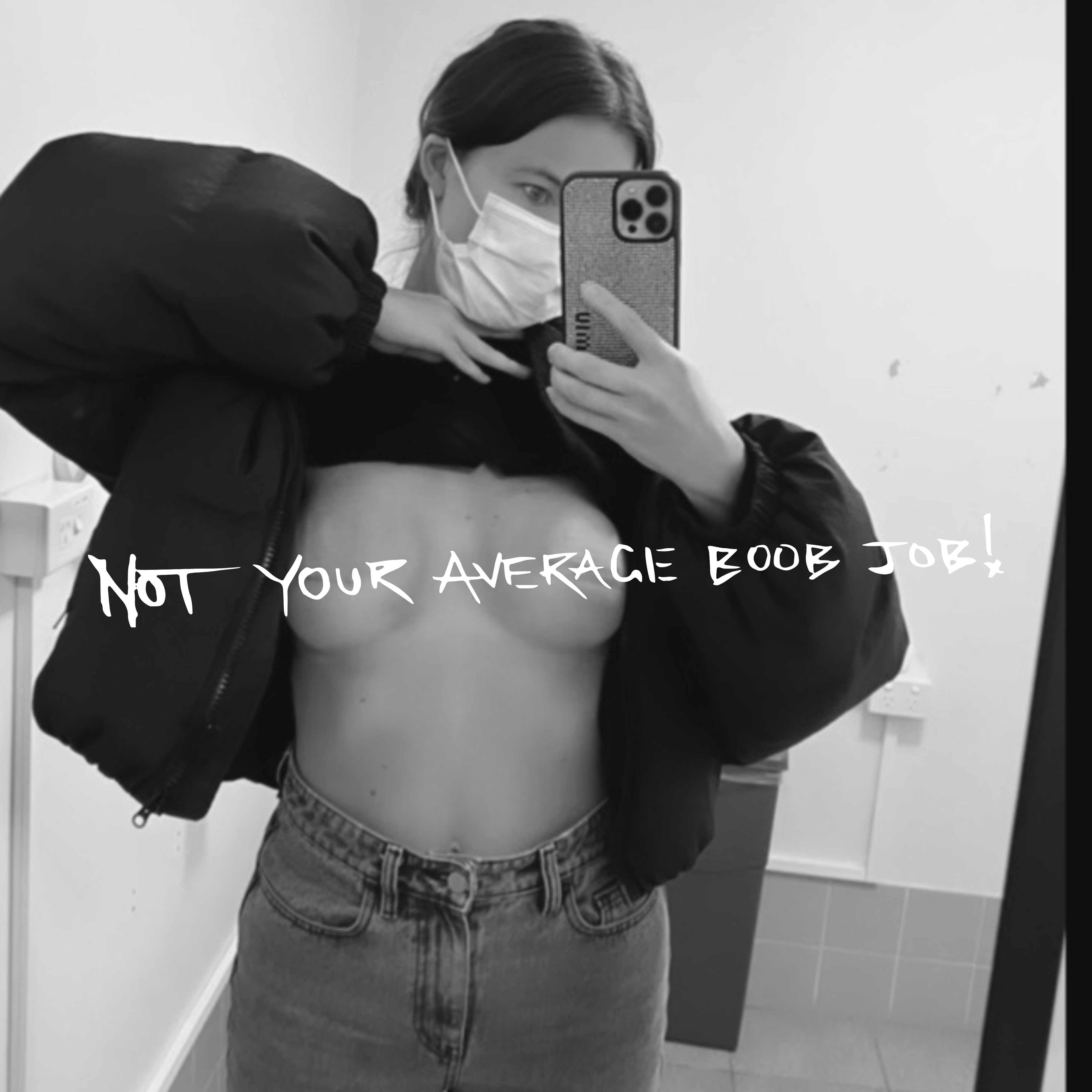 Not your average boob job!